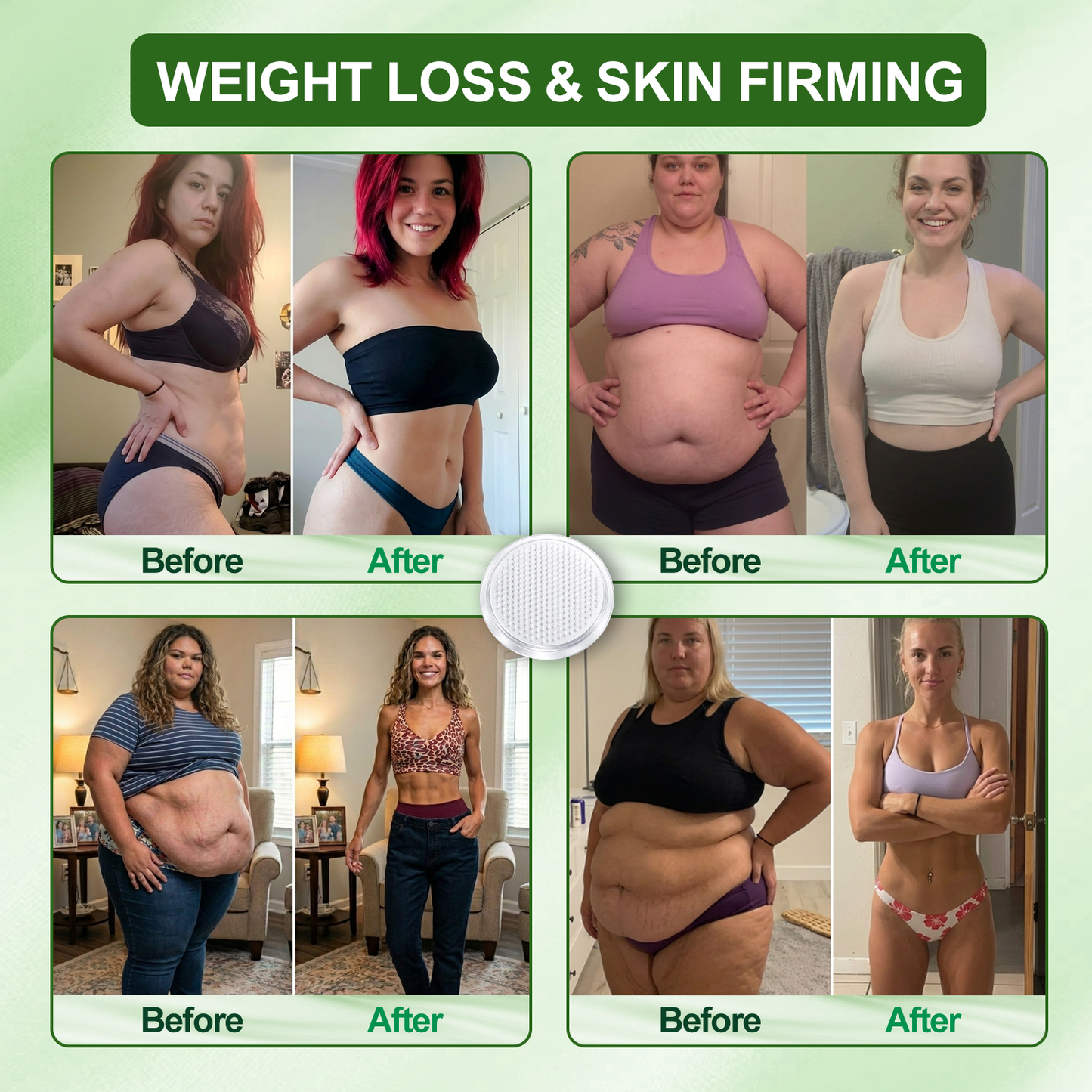 🇺🇸𝐂𝐚𝐫𝐞𝐔𝐩𝐥𝐢𝐟𝐭® 𝑴𝒆𝒕𝒂𝒃𝒐𝒍𝒊𝒄 𝑵𝒂𝒏𝒐 𝑴𝒊𝒄𝒓𝒐𝒏𝒆𝒆𝒅𝒍𝒆 𝑷𝒂𝒕𝒄𝒉(🔥 𝟏 𝐏𝐚𝐭𝐜𝐡 𝐃𝐚𝐢𝐥𝐲 • 𝐕𝐢𝐬𝐢𝐛𝐥𝐞 𝐢𝐧 𝟕 𝐃𝐚𝐲𝐬）𝘽𝙚𝙧𝙗𝙚𝙧𝙞𝙣𝙚 + 𝙈𝙤𝙧𝙞𝙣𝙜𝙖 𝙁𝙤𝙧𝙢𝙪𝙡𝙖 ✅ 𝐅𝐨𝐫 𝐨𝐛𝐞𝐬𝐢𝐭𝐲, 𝗟𝗼𝗼𝘀𝗲 𝘀𝗸𝗶𝗻,𝐝𝐢𝐚𝐛𝐞𝐭𝐞𝐬, 𝐬𝐥𝐞𝐞𝐩 𝐚𝐩𝐧𝐞𝐚, 𝐣𝐨𝐢𝐧𝐭 𝐢𝐬𝐬𝐮𝐞𝐬, 𝐚𝐧𝐝 𝐦𝐨𝐫𝐞