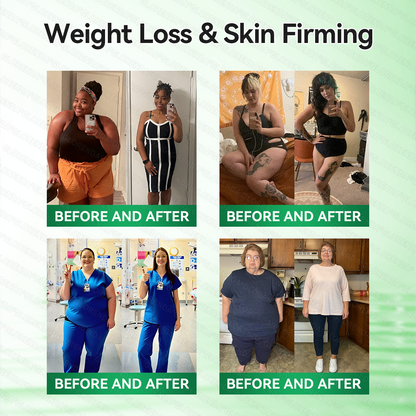 🇺🇸𝐂𝐚𝐫𝐞𝐔𝐩𝐥𝐢𝐟𝐭® 𝑴𝒆𝒕𝒂𝒃𝒐𝒍𝒊𝒄 𝑵𝒂𝒏𝒐 𝑴𝒊𝒄𝒓𝒐𝒏𝒆𝒆𝒅𝒍𝒆 𝑷𝒂𝒕𝒄𝒉(🔥 𝟏 𝐏𝐚𝐭𝐜𝐡 𝐃𝐚𝐢𝐥𝐲 • 𝐕𝐢𝐬𝐢𝐛𝐥𝐞 𝐢𝐧 𝟕 𝐃𝐚𝐲𝐬）𝘽𝙚𝙧𝙗𝙚𝙧𝙞𝙣𝙚 + 𝙈𝙤𝙧𝙞𝙣𝙜𝙖 𝙁𝙤𝙧𝙢𝙪𝙡𝙖 ✅ 𝐅𝐨𝐫 𝐨𝐛𝐞𝐬𝐢𝐭𝐲, 𝗟𝗼𝗼𝘀𝗲 𝘀𝗸𝗶𝗻,𝐝𝐢𝐚𝐛𝐞𝐭𝐞𝐬, 𝐬𝐥𝐞𝐞𝐩 𝐚𝐩𝐧𝐞𝐚, 𝐣𝐨𝐢𝐧𝐭 𝐢𝐬𝐬𝐮𝐞𝐬, 𝐚𝐧𝐝 𝐦𝐨𝐫𝐞