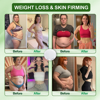 🇺🇸𝐂𝐚𝐫𝐞𝐔𝐩𝐥𝐢𝐟𝐭® 𝑴𝒆𝒕𝒂𝒃𝒐𝒍𝒊𝒄 𝑵𝒂𝒏𝒐 𝑴𝒊𝒄𝒓𝒐𝒏𝒆𝒆𝒅𝒍𝒆 𝑷𝒂𝒕𝒄𝒉(🔥 𝟏 𝐏𝐚𝐭𝐜𝐡 𝐃𝐚𝐢𝐥𝐲 • 𝐕𝐢𝐬𝐢𝐛𝐥𝐞 𝐢𝐧 𝟕 𝐃𝐚𝐲𝐬）𝘽𝙚𝙧𝙗𝙚𝙧𝙞𝙣𝙚 + 𝙈𝙤𝙧𝙞𝙣𝙜𝙖 𝙁𝙤𝙧𝙢𝙪𝙡𝙖 ✅ 𝐅𝐨𝐫 𝐨𝐛𝐞𝐬𝐢𝐭𝐲, 𝗟𝗼𝗼𝘀𝗲 𝘀𝗸𝗶𝗻,𝐝𝐢𝐚𝐛𝐞𝐭𝐞𝐬, 𝐬𝐥𝐞𝐞𝐩 𝐚𝐩𝐧𝐞𝐚, 𝐣𝐨𝐢𝐧𝐭 𝐢𝐬𝐬𝐮𝐞𝐬, 𝐚𝐧𝐝 𝐦𝐨𝐫𝐞